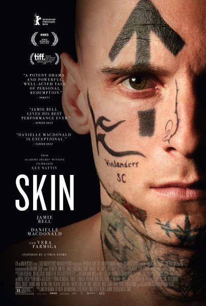 Archivo:Skin-988774585-large.jpg
