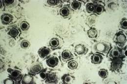 Herpes genital.jpg