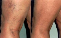 Trast circulat php.jpeg