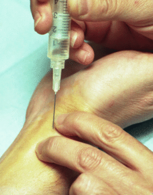 Gasometria-arterial-jpg.gif