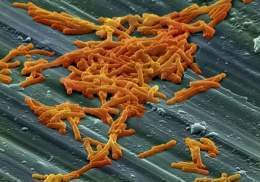 Clostridium-difficile-bacteria.jpg