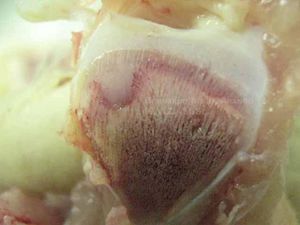 Discondroplasia tibial (Small).jpg
