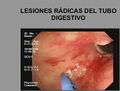 Miniatura de la versión del 09:26 11 mar 2020