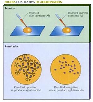 Prueba cualitativa de aglutinacion.jpg
