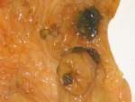 Botones intestino - peste porcina clasica.jpg