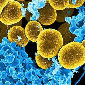 Coagulase-negative-staphylococcus.jpg