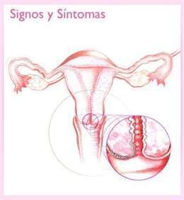 Hemorr-uterina-disfunc .jpg