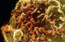 El virus VIH entra en contacto con los tejidos sanos y se autorreplica.JPG