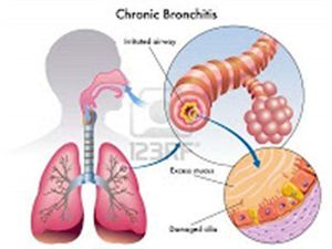 1.- Bronquitis-cronica. (Small).jpg