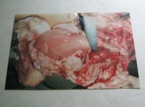 Leucosis bovina.jpg