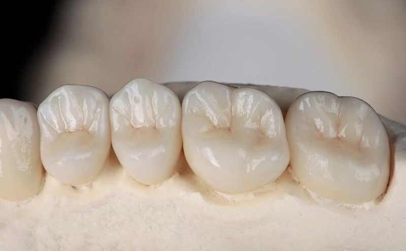 Archivo:Molares-dientes-825x510.jpg