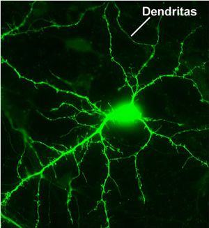 Dendrita.jpeg