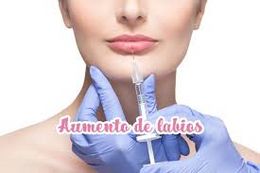 Implantes de colágeno.jpg