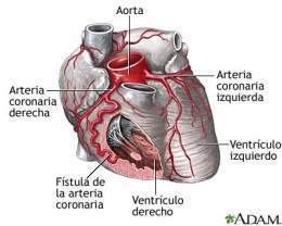 Fistula coronaria.jpg