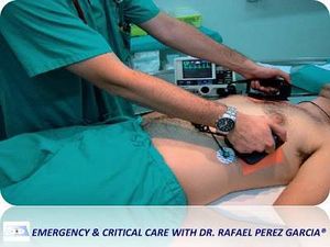 Trat arritm emergencia-469.jpg
