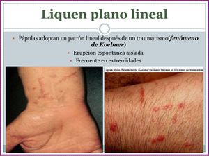 Enfermedades-eritemoescamosas-65-638.jpg