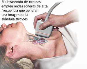 Ultrasonido de tiroides.jpg