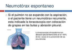 Neumotorax-4-728.jpg