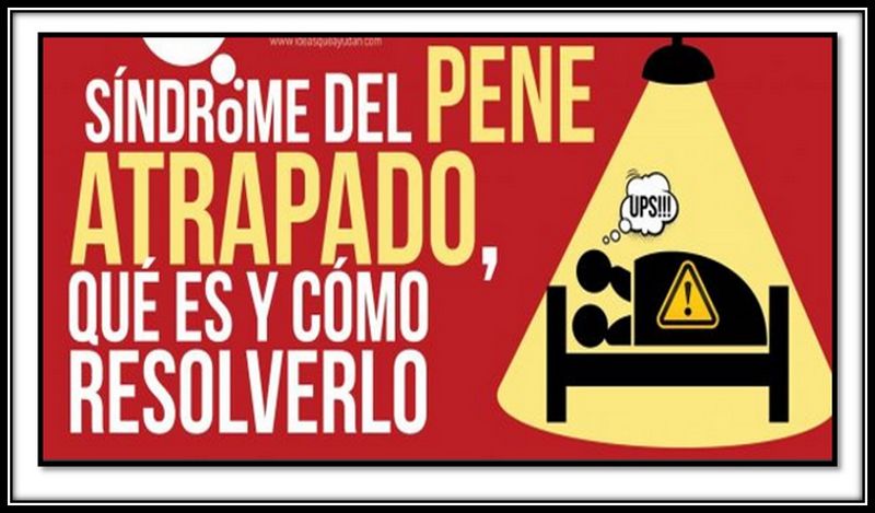 Archivo:Paniscaptivus.jpg
