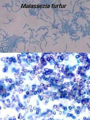 Malassezia furfur.jpg