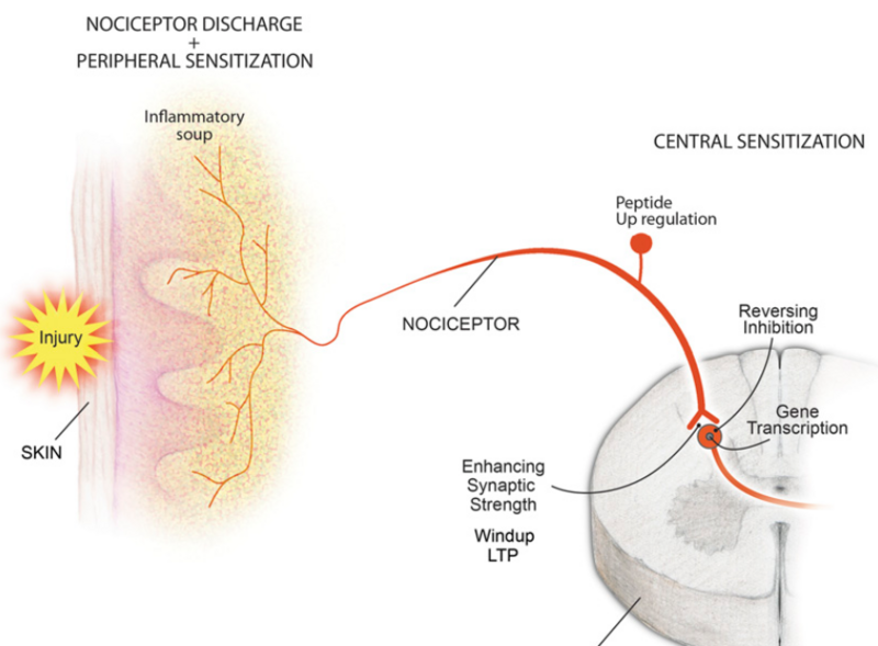 Archivo:Nociceptor2.png