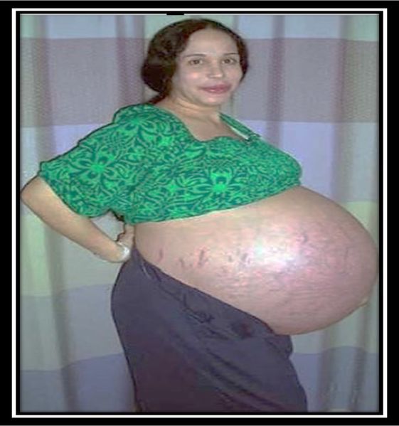 Archivo:Octomom 4.jpg