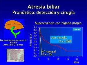 Atresia de los conductos intrahepáticosfigura3.jpg