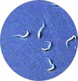 papiloma virus bradavice