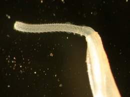 Acanthocephala.jpg
