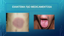 Exatema 1.jpg