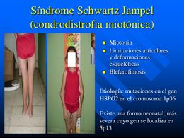 SindromeS.jpg