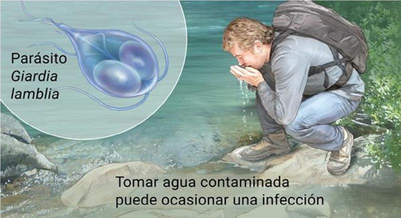 Archivo:Giardiasis.jpg