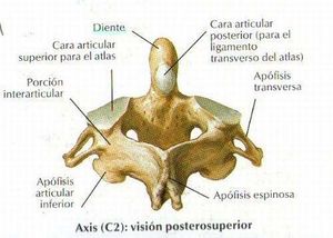 Vertebra cervica axis.jpg