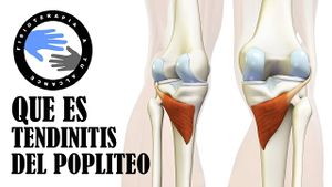 Tendinitis poplitea.jpg