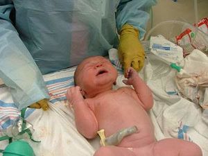 Problemas medicos bebe pulmon humedo.jpg
